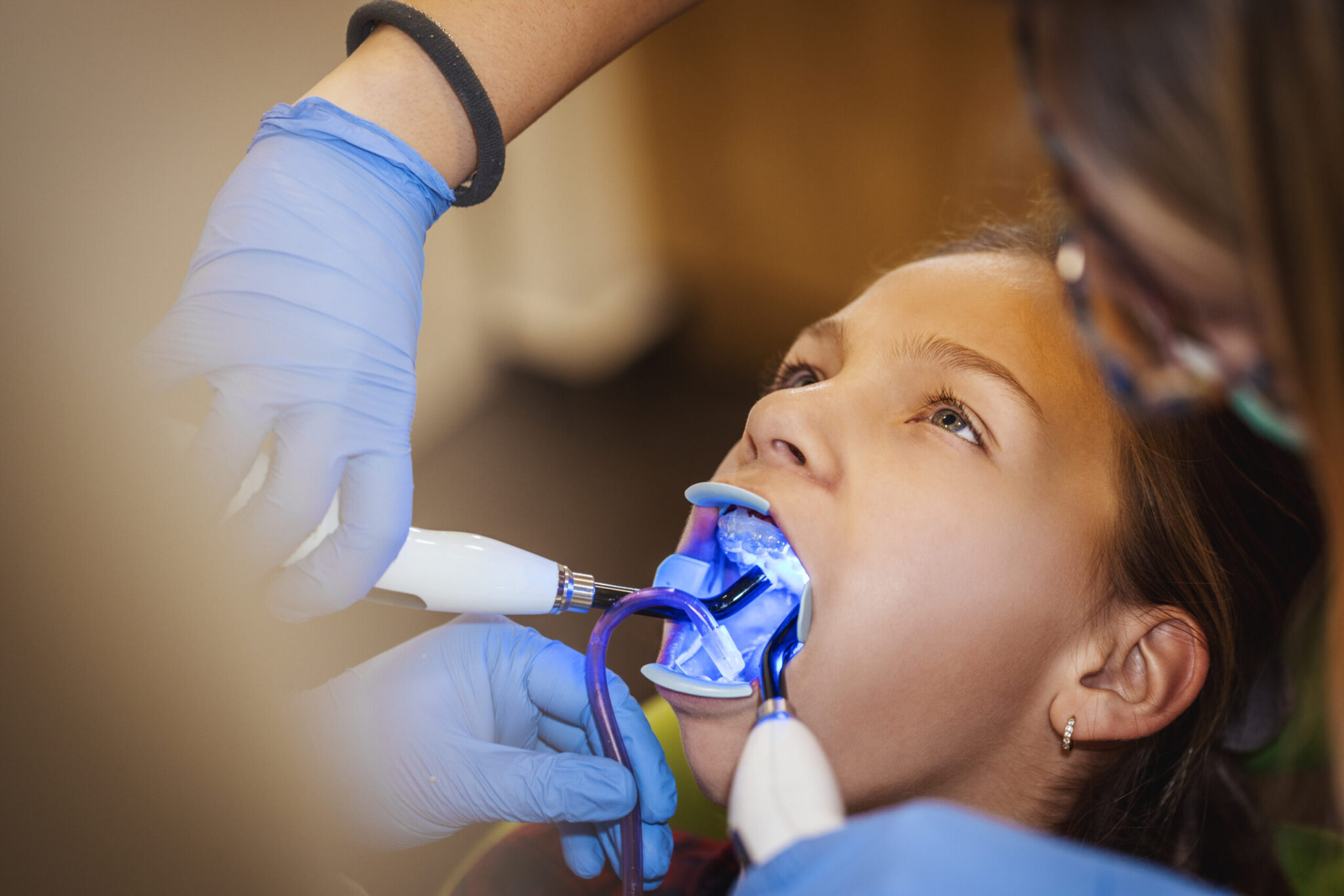 Child receiving a dental treatment with a blue curing light at Long Island Pediatric Dentistry in Lawrence, NY