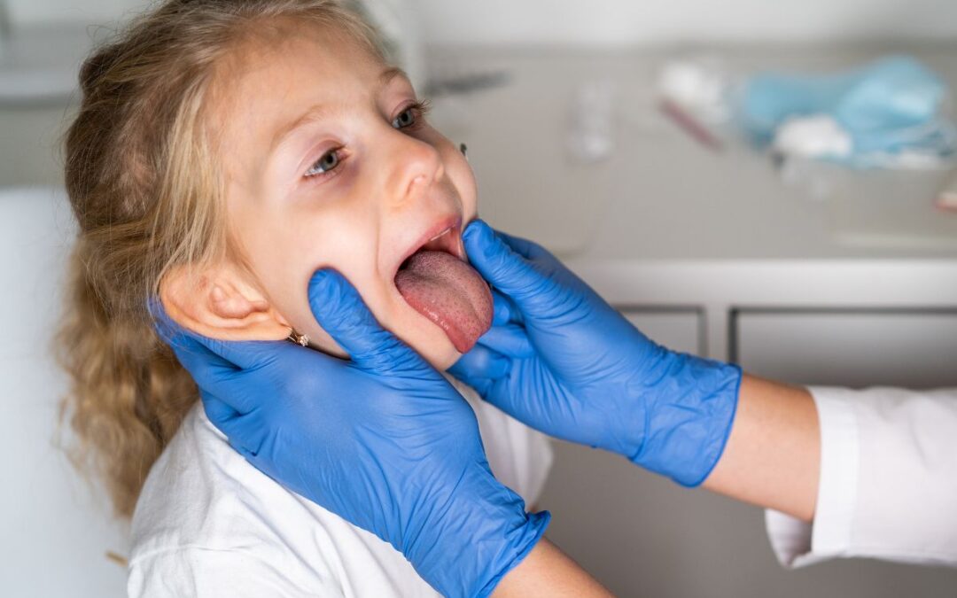 What Parents Should Know About Tongue-Tie and Speech Development