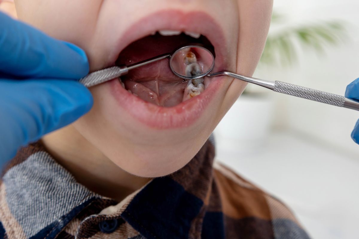 Pediatric dentist evaluating a child's dental filling in Lawrence NY